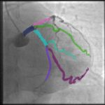 Desarrollan método experimental a partir de imágenes para prevenir enfermedades cardiacas