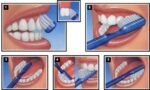 Especialista dental recomienda realizar el cepillado de dientes con los elementos adecuados para evitar daños a las encías y boca
