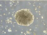 Investigadores buscan revertir la resistencia al tratamiento en Cáncer Cervicouterino Investigadores buscan revertir la resistencia al tratamiento en Cáncer Cervicouterino