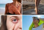 La ropa que usamos, protector solar, y hasta gafas de sol, nos pueden salvar de enfermedades provocadas por las altas temperaturas La ropa que usamos, protector solar, y hasta gafas de sol, nos pueden salvar de enfermedades provocadas por las altas temperaturas