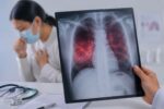 La tuberculosis es curable si se detecta y trata oportunamente La tuberculosis es curable si se detecta y trata oportunamente