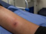 Secretaría de Salud confirma que en Sinaloa no se han detectado casos de gusano barrenador en humanos Secretaría de Salud confirma que en Sinaloa no se han detectado casos de gusano barrenador en humanos