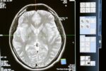 Cada respiración tiene un impacto único en el cerebro Cada respiración tiene un impacto único en el cerebro